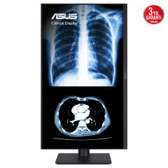 ASUS KLİNİK MONİTÖR MH2441A 23.8 IPS 3.6MP 2560x1440 5ms 75Hz 300cd DP HDMI USB-C YOK VESA 3YIL AGLR DICOM PART 14 GSDF DICOM ÖN AYARI OTOMATİK KALİBRASYON JND <%10 ANTİBAKTERİYAL KAPLAMA DAISY CHAIN